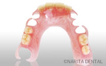 ナチュラルデンチャー